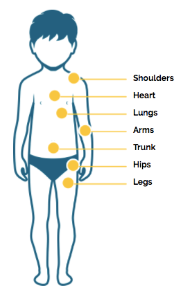 Duchenne Muscular Dystrophy Disease Progression Duchenne Com