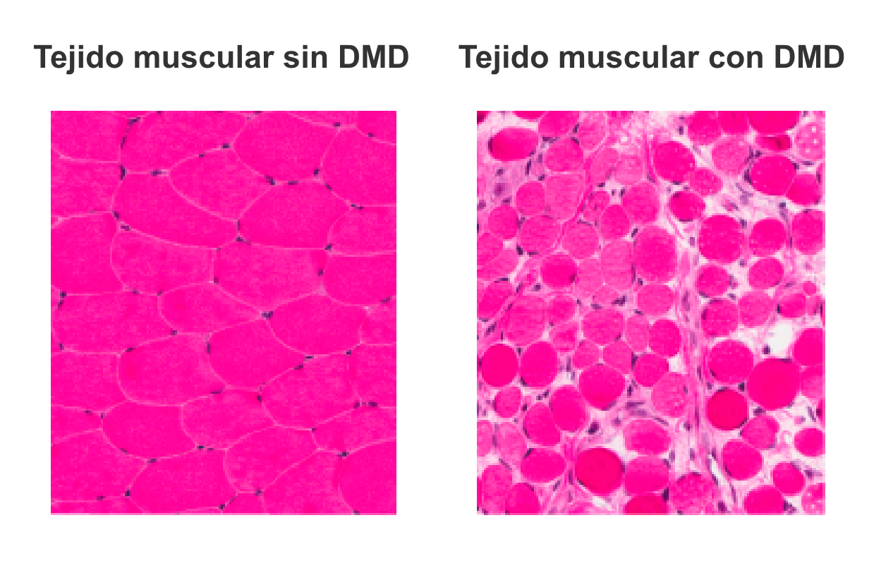 Tejido muscular sin DMD